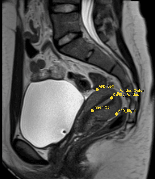 Sagittal MRI · landmarks overlaid